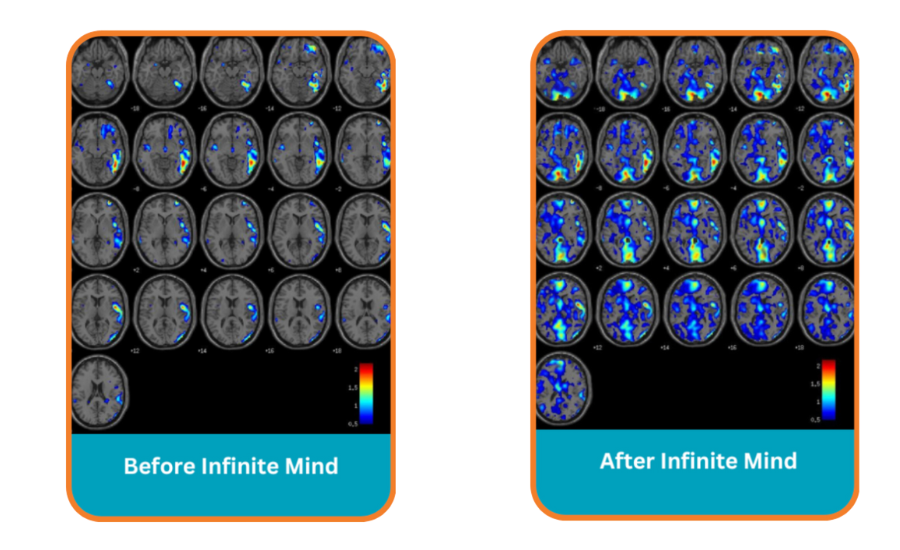 Read Faster &amp; Train your Brain (1)