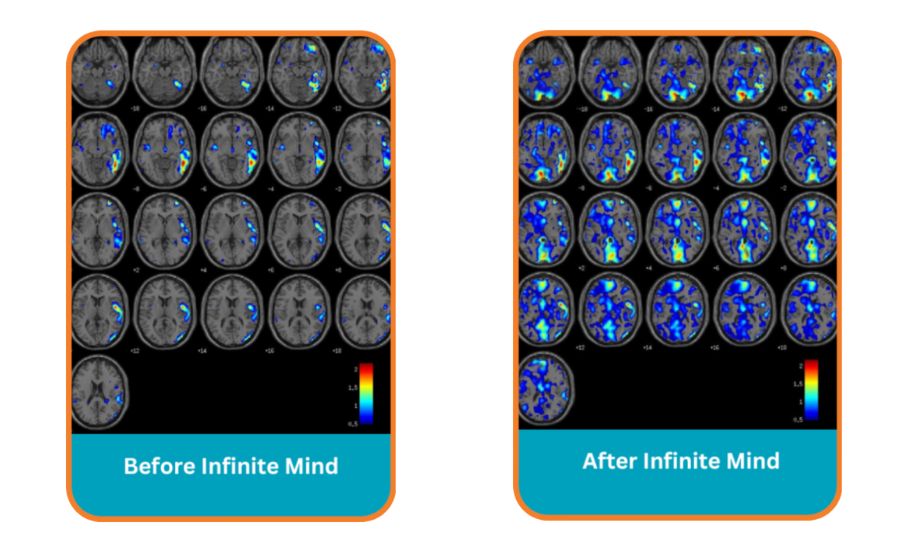 read-faster-train-your-brain-4