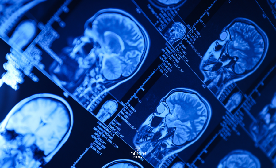 im-blog-memory-loss